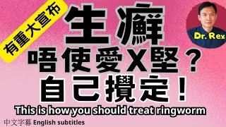 股癬、腳癬痕癢難當？ 醫生教你一招K.O. this is how you should treat ringworm