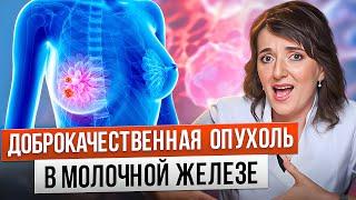 УПЛОТНЕНИЕ в груди, ЧТО ДЕЛАТЬ? Фиброаденома и киста молочной железы | Опасно ли и как лечиться?