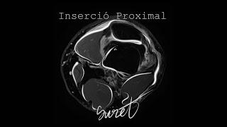 Suret - Inserció Proximal (Videomaqueta)