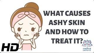 WHAT CAUSES ASHY SKIN AND HOW TO TREAT IT