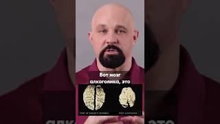 КАК АЛКОГОЛЬ ВЛИЯЕТ НА МОЗГ? ВИДЕО НА КАНАЛЕ #василийшуров #нарколог #зависимость #алкоголизм