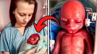 21 Most UNUSUAL Babies That Were Born Different