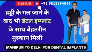 Best Dental Hospital in India | best implant dentist in India | full mouth dental implants India