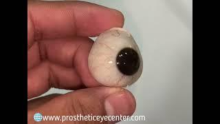 Artificial eye| Prosthetic eye| False eye| lost eye treatment| Artificial lens