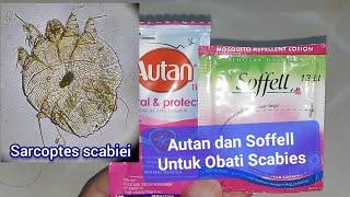 Autan Soffell Untuk Mengobati Scabies | Sarcoptes scabiei  | Kudis