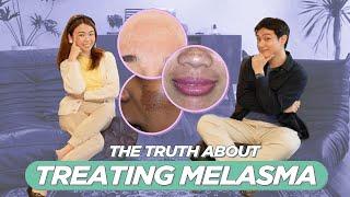 Best Way to Treat MELASMA / PEKAS? Dermatologist Answers & Explains! (Filipino) | Jan Angelo