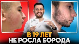 БОРОДА С НУЛЯ ВСЕГО ЗА 4 МЕСЯЦА / Результаты mr.Volos