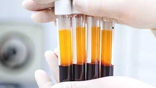 What is GFC(Growth Factor Concentrate)?