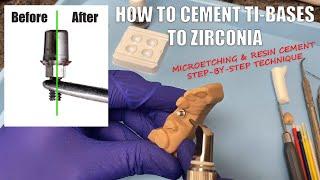 How to Cement Ti-Bases to Zirconia Crowns - Using MicroEtchers and Resin Cement