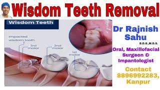 Wisdom Tooth Removal || 3rd Molar Surgery || @rajnishsahu82