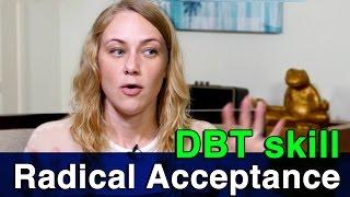 DBT Skill: Radical Acceptance