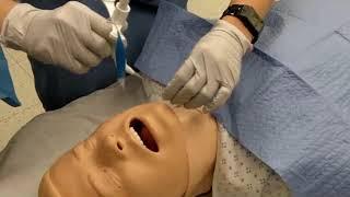 Surgical tracheostomy procedure