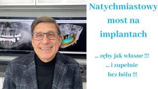 Zęby na implantach - leczenie w jeden dzień !  Jeden bezbolesny zabieg !