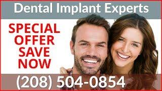 Dental Implant Cost Meridian ID  (208) 856-0684 Dental Implants Special Offers Meridian Idaho