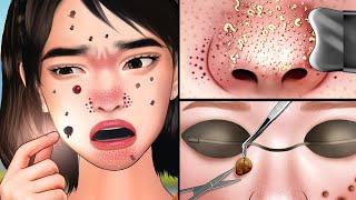 ASMR Skincare and Moles Removal | ASMR Sebum Removal and Skincare Animation