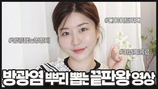 SUB) 소변 자주 보는 사람 꼭 봐️방광염 치료하고 재발까지 막는 유일한 영상️ 방광염 증상 | 방광염 운동 | 방괌염 영양제 | 방광염 치료방법 | 최모나choimona