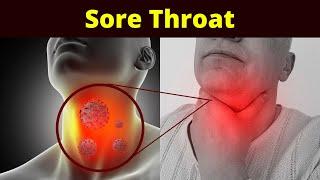 Home Remedies for Sore Throat (Throat Infection)| Natural Remedies| Natural Treatment|