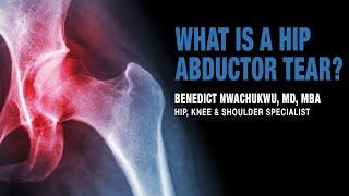 What is a Hip Abductor Tear | Trochanteric Pain Syndrome Treatment | Manhattan, New York, Brooklyn