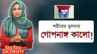 শরীরের তুলনায় গোপনাঙ্গ কালো । SexEdu with Dr Dristy