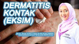 Dermatitis Kontak (Eksim), Apa Penyebabnya?