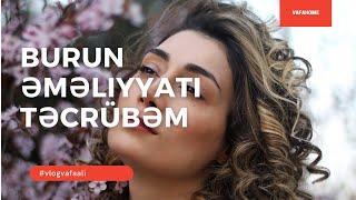 Burun əməliyyatına necə hazırlaşmalı / şəxsi təcrübəm