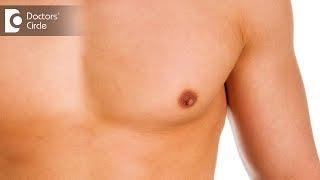 Complications associated to gynecomastia surgery - Dr. Sreekar Harinatha