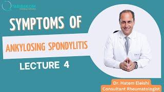 Ankylosing spondylitis series. Video 4: Symptoms of ankylosing spondylitis. Dr. Hatem Eleishi