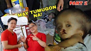 GOODNEWS! Batang may HYDROCEPHALUS at CLEFT may NAGPAABOT na ng TULONG! | BP Charity Ep.2 p.2