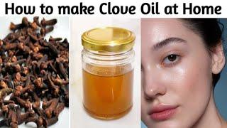 Anti-Acne and Anti-aging Clove Oil to get Fair, Spotless, AcneFree & Wrinkle Free Skin