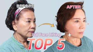 TOP5 Face lifting Plastic Surgery TransformationsㅣNANA Plastic Surgery Korea