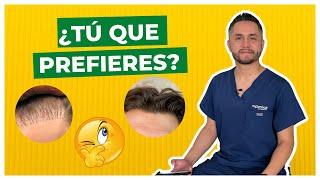 Si estas Buscando Realizarte un INJERTO CAPILAR  VE ESTE VIDEO