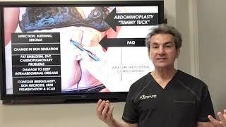 What are the potential complications of tummy tuck surgery by Dr. Iraniha