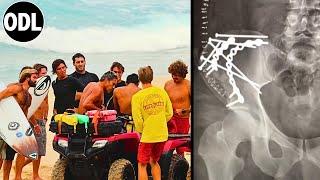 Multiple Pelvic Fractures at Pipeline | Joaquin Del Castillo Breaks Hip, Undergoes Surgery at Queens