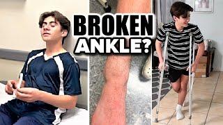 SENT TO THE HOSPITAL FOR AN X-RAY FOR A BROKEN ANKLE | IS HIS ANKLE BROKEN | DOES HE NEED CRUTCHES?