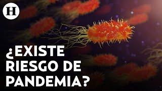 Bacteria carnívora que puede llegar a matar en 2 días alerta por aumento de casos en Japón