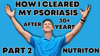 My Journey to Conquering Psoriasis | What I ate to Heal my Skin