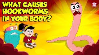 What causes Hookworm?। Intestinal Worms Symptoms and Treatment | Worm Infection | Dr. Binocs Show