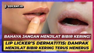 Hati Hati Kebiasaan Menjilat Bibir Malah Bikin Bibir Semakin Kering