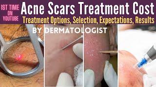 Acne Scars Treatment Cost In India | Acne Scar Treatment Options, Results, Expectations | Jaipur