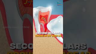 When Should Kids Get Braces? The Perfect Timing Explained!