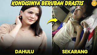 Pantas Tak tampil di TV lagi, 8 artis ini alami sakit parah & sedang berjuang untuk kesembuhannya