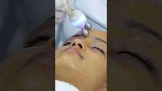 Hydra Facial Treatment at Skinaa Clinic #hydrafacialtreatment #hydrafacial #shorts  #skinaaclinic