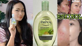 ESKINOL SPOT-LESS GLOW FACIAL DEEP CLEANSER W/ PURE CALAMANSI EXTRACT(TONER SA ACNE PRONE SKIN)