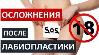 ️ОСЛОЖНЕНИЯ ПОСЛЕ ЛАБИОПЛАСТИКИ  ️ТОЛЬКО 18+