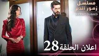 اعلان الترويجي للحلقة 28 | مسلسل زهور الدم | مدبلج بالعربية | Kan Çiçekleri