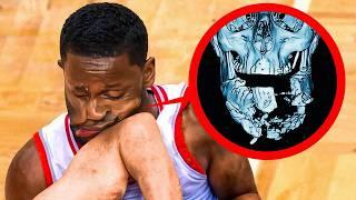 Most DANGEROUS Injuries in NBA..