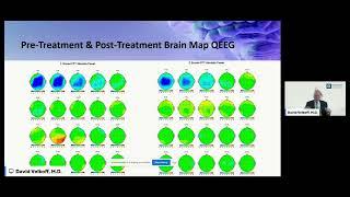 How Neurofeedback Improves Brain Functioning & Reduces Autism Symptoms