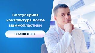 ОСЛОЖНЕНИЕ Капсулярная контрактура после маммопластики Пластический хирург Андрей Анеликов