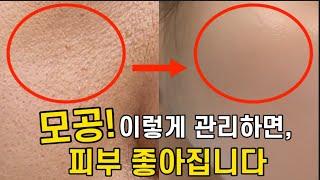 커진 모공 줄이는 법모공 피지 블랙헤드 종결판!!! 피부 좋아지는 모공 관리법 / 토너패드,레티놀,모공줄이기