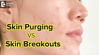 What is skin purging ? Is it the same as skin breakouts? - Dr. Rajdeep Mysore|Doctors' Circle